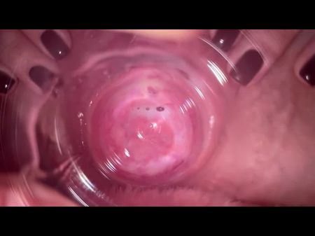 internal camera of pussy