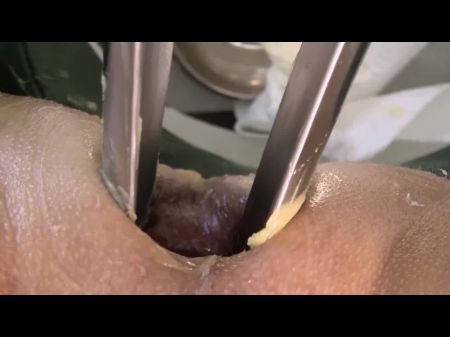 hospital doctor sexxx