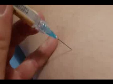 ass injections