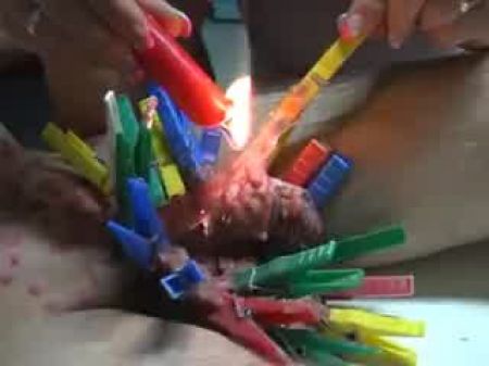 it burns